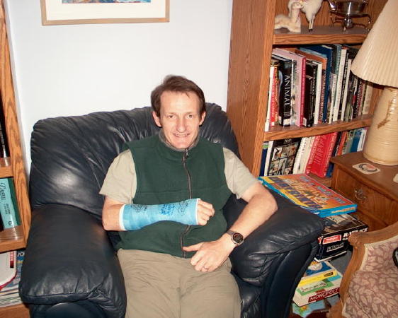 Mike broke his wrist!